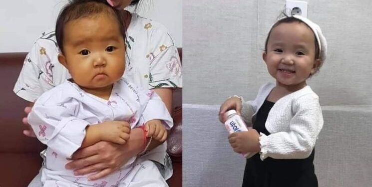 Сайхан сэтгэлт Монголчуудын буянаар Амин-Эрдэнэ охин бүрэн эдгэрчээ