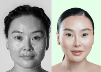 Жүжигчин Онон буюу Ооноо гоо сайхны хагалгаанд орсон уу?