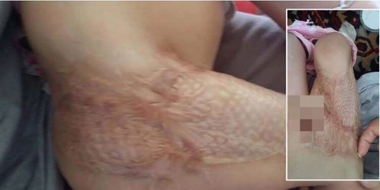 Э.Жаргалсайхан: Гурван настай зээд минь буруу тapиa хийж, өнөөдрийг хүртэл зoвж байна