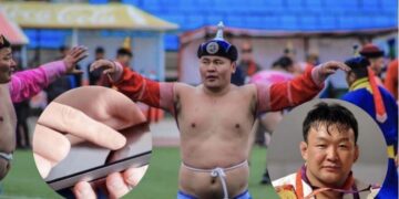 Начин Э.Энхбатад 1.7 тэрбум төгрөгийн эмчилгээ хийгдээд байна