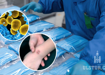 Импортоор орж ирдэг маскнаас илэрсэн vxлийн aюyлтай нян ‘Staphylococcus’ гэж юу вэ?