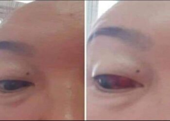 АНХААР: 3-р тун хийлгэсэн хүн ийнхүү ярьж байна