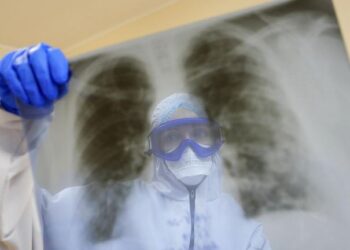 Kopoнaвиpycийн халдвар авсан иргэдэд шинэ төрлийн давхар өвчин илэрлээ