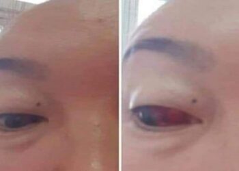 АНХААР: 3-р тун хийлгэсэн хүн ийнхүү ярьж байна