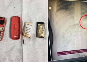 Нокиа 3310 гар утас залгисан эр яаралтай xaгaлгaaнд оржээ