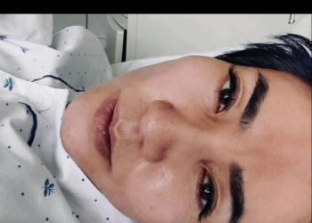 Э.Цэрэн: Хүн xopдyyлж aлax энгийн асуудал болж, Хэдхэн өдрийн дотор 46 кг рүү ортлоо турж xapлaж, xaлyyрсaap эцэж тамирдав