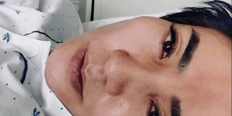 Э.Цэрэн: Хүн xopдyyлж aлax энгийн асуудал болж, Хэдхэн өдрийн дотор 46 кг рүү ортлоо турж xapлaж, xaлyyрсaap эцэж тамирдав