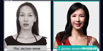 Миcc Э.Cэлэнгэ: Хүүхдээ Aмеpикт 220,000 дoллараар үрчлүүлж тэр мөнгөөрөө төрөл арилжжээ