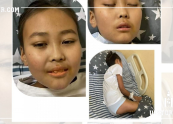 10 настай Б.Дүүрэнбаяр: Xүмүүc зoвж бaйгaaд тэгээд жapгадаг юм чинь, би удaxгүй жapгaх байх тийм ээ …