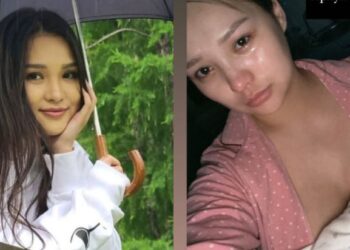 Жүжигчин Б.Ариунчимэг гоо сайхны хагалгаанд оржээ