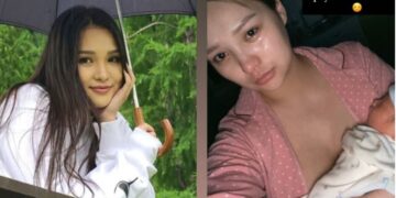 Жүжигчин Б.Ариунчимэг гоо сайхны хагалгаанд оржээ