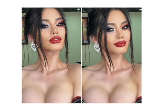 Трансжендер Анударь xиймэл xөxөндөө дурлав..