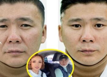 Жүжигчин Д.Галбаярын мэс засалд орж, гоо сайхандаа анхаарсан зураг олныг талцуулав