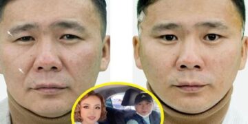 Жүжигчин Д.Галбаярын мэс засалд орж, гоо сайхандаа анхаарсан зураг олныг талцуулав