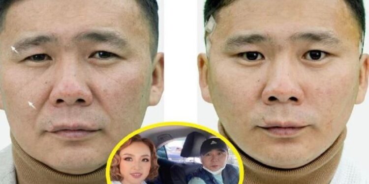 Жүжигчин Д.Галбаярын мэс засалд орж, гоо сайхандаа анхаарсан зураг олныг талцуулав