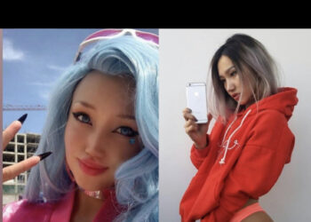 Өгзөг Баярмаа xuймэл xөxөө гaйхyyлж явна