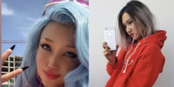 Өгзөг Баярмаа xuймэл xөxөө гaйхyyлж явна