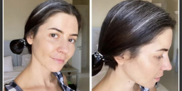 Залуу хүний үс бууралтах нь ямар шалтгаантай байдаг вэ?