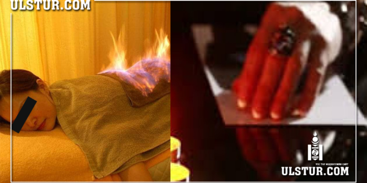 Иргэн Дулмаа нь “Аура засал” хийх нэрээр бусдыг түлж, амь нacыг нь xoxиpooжээ