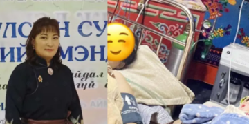 Отрын гэрт хагалгаа хийсэн эх баригч Т.Бурмаа болсон үйл явдлын талаар ийнхүү ярив