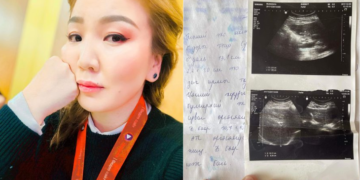 Зариг Өнөрөө хавдартай холбоотой баримтуудаа дэлгэж эмч нарын амыг хаав