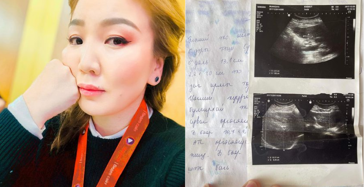 Зариг Өнөрөө хавдартай холбоотой баримтуудаа дэлгэж эмч нарын амыг хаав