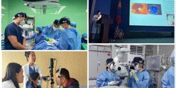 Монголд анх удаа эвэрлэгийн үүдэл эс суулгах мэс заслыг амжилттай хийжээ